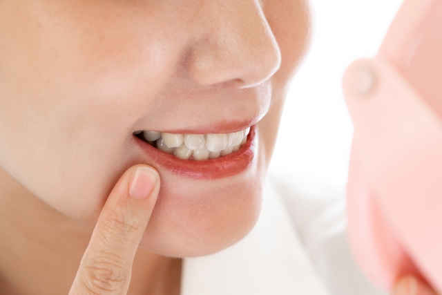 前歯のセラミック治療の方法